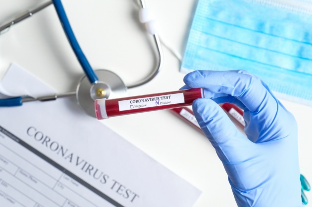 Immagine Coronavirus, Toscana nella fase 2: test sierologici e indicatori di sorveglianza